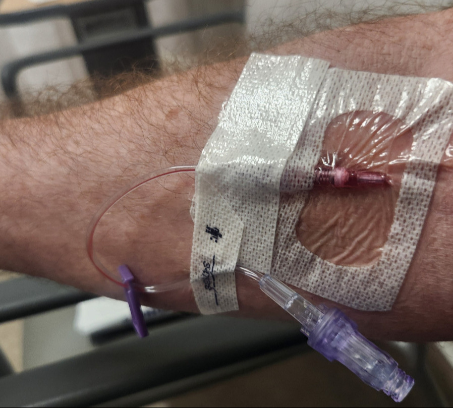 IV in arm